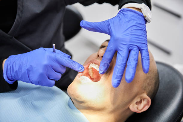 Best Emergency Wisdom Teeth Removal in Chigan Center, MI